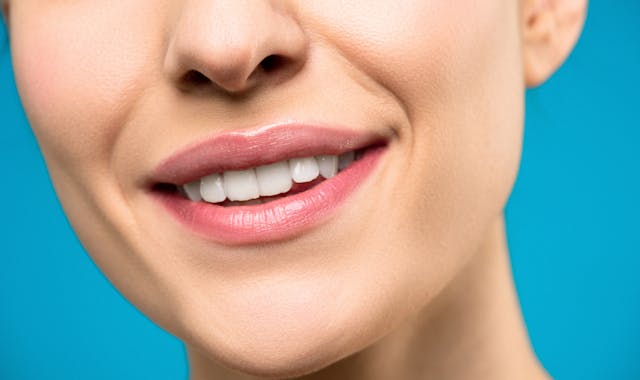 Sorriso perfetto: i trattamenti di odontoiatria estetica più richiesti oggi